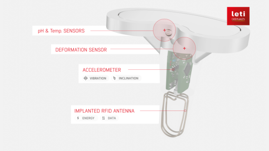 CEA-Leti FollowKnee multi-sensor system