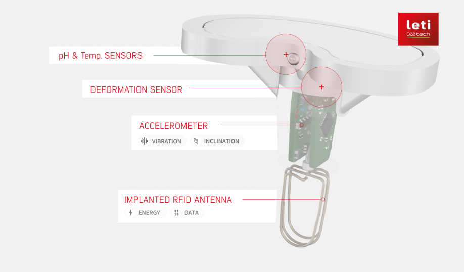 CEA-Leti FollowKnee multi-sensor system