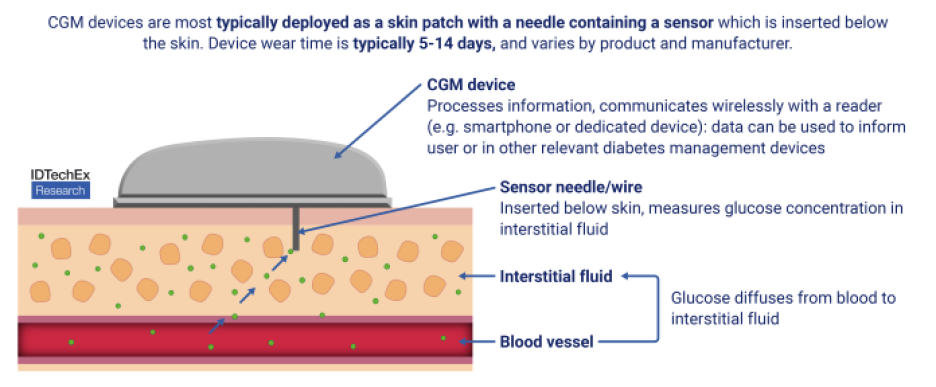 CGMs are commonly used as a skin patch, with a wear time of five to 14 days.