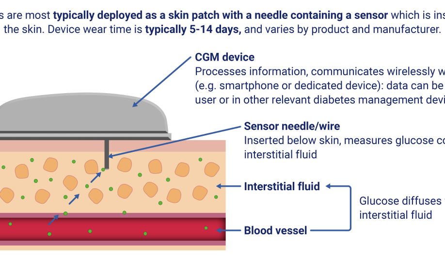 CGMs are commonly used as a skin patch, with a wear time of five to 14 days.