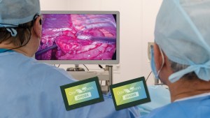 Omnivision's image sensors for endoscopes