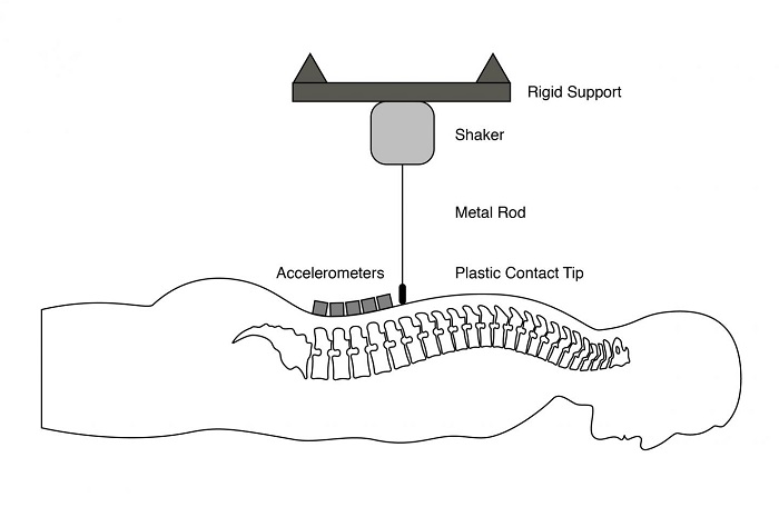 Sketch of spine vibration technology