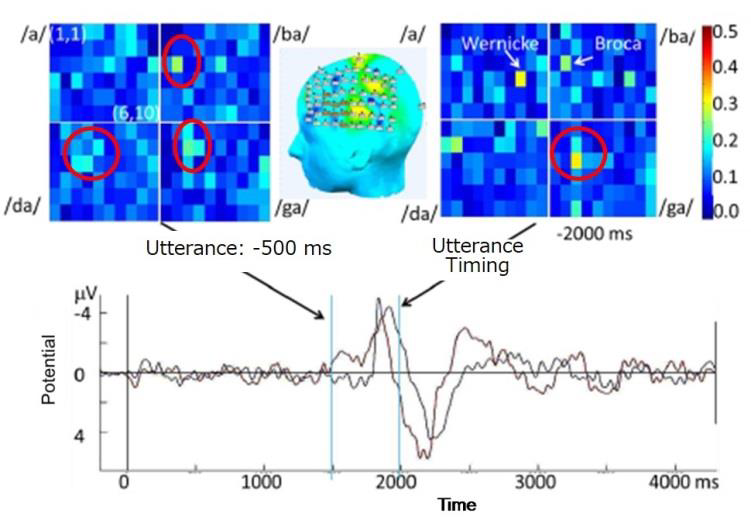 Brainwave_Speech