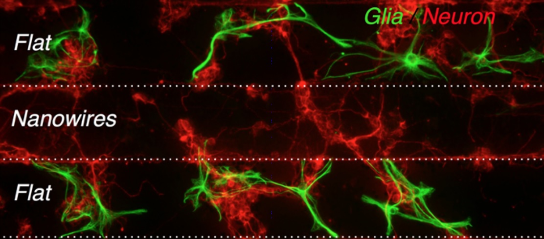 nanowires_brain implants