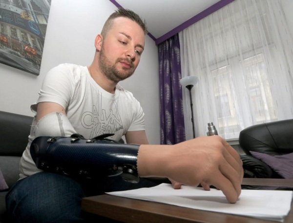 Writing with mind controlled prosthetic hand