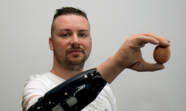 Man holding egg with mind controlled prosthetic hand