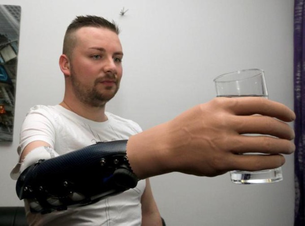 Man pouring water with mind controlled prosthetic hand