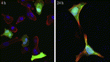 confocal microscopy