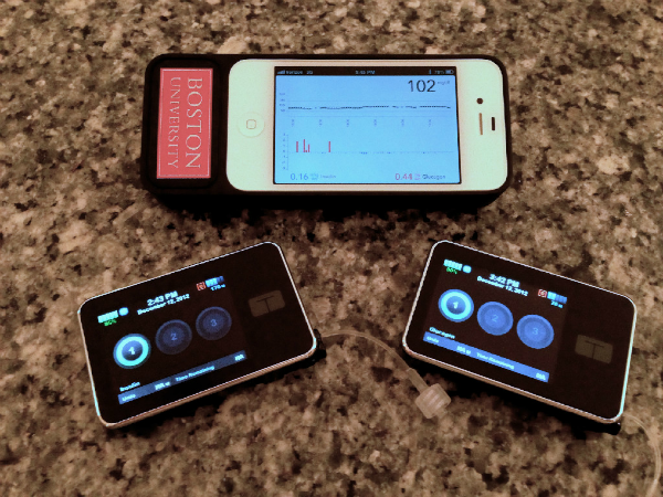 Bionic Pancreas