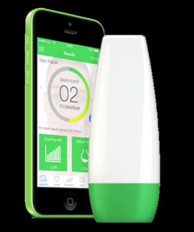 ScanZ zit device and app