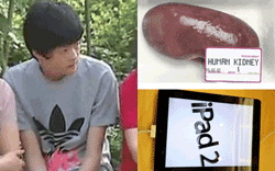 Report: Kid sells kidney for iPhone and iPad, now suffers from renal deficiency