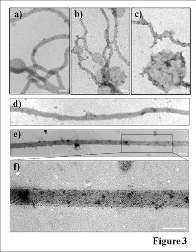 Group creates magnetic bacteria, could lead to biocomputers