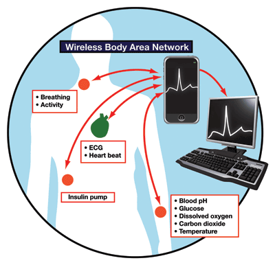 Technologies for remote patient monitoring