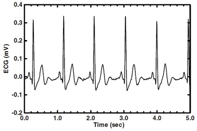 Sensor requirements for portable ECG monitoring