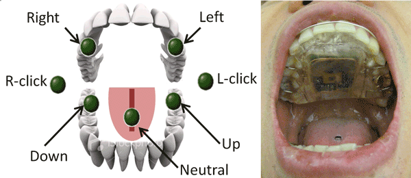 Tongue drive system operates a computer and wheelchair