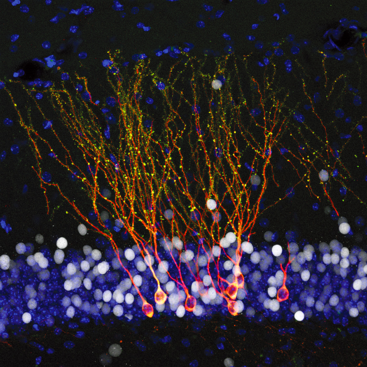 NESD_Program_Neurons