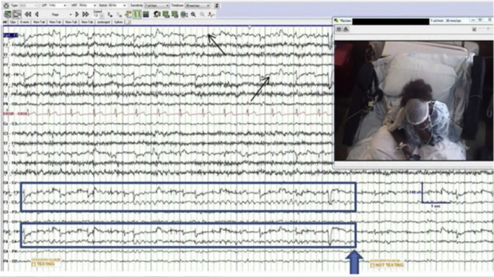 Brain wave pattern while texting