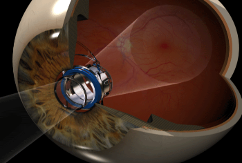 How optical telescope works