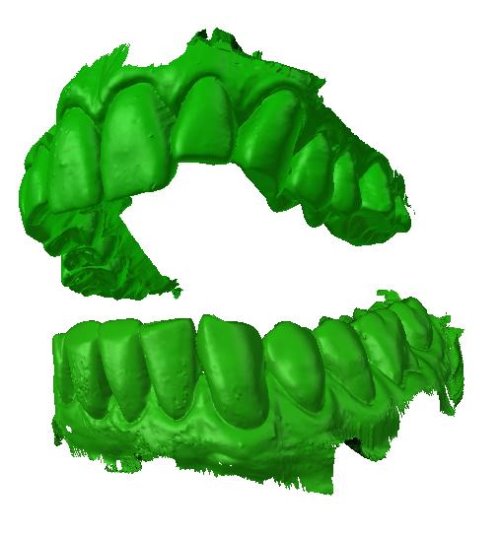 3D teeth scans