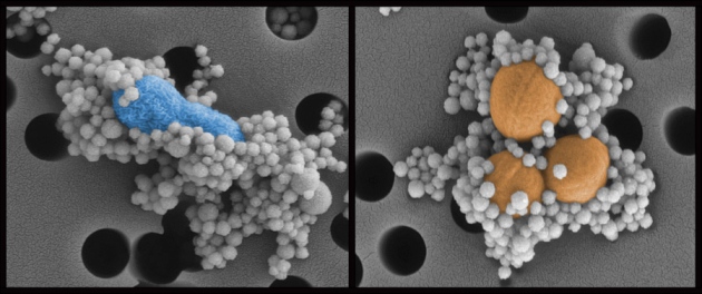 Infections running through biospleen