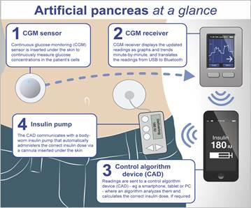 newspo01_Cambridge_PancreasMeter_18jun2013