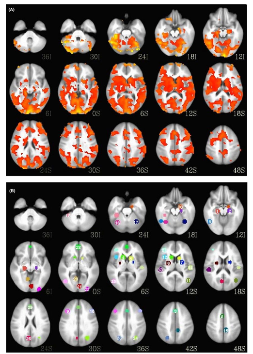 Brain_Scans