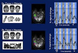 brainscanmit2